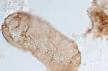 Aux origines de la photosynthèse