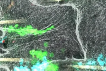 Les propriétés physiques de la peau responsables de la cicatrisation des plaies