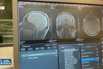 Le cerveau humain dans l'espace