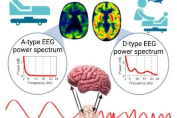 Couplage électrométabolique cérébral dans les états de conscience normaux et désordonnés