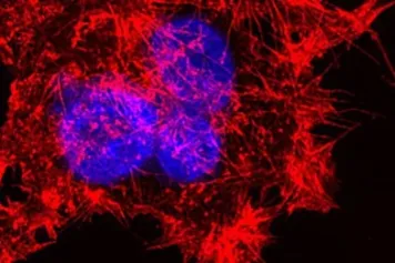 PUBLICATION SCIENTIFIQUE | FAT1 : découverte d'un gène dont la mutation favorise les métastases de certains cancers