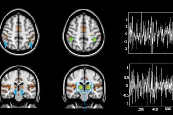 Les rôles du locus coeruleus et du thalamus sur notre sommeil et la stimulation de notre cerveau