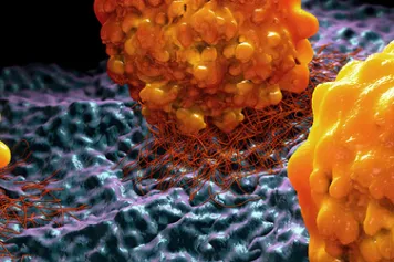 Prévenir les métastases en empêchant les cellules cancéreuses de faire du gras