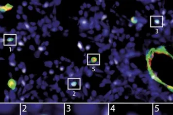 PUBLICATION SCIENTIFIQUE | Nouvelle immunothérapie pour vaincre le cancer