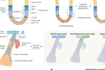 Plasticité des cellules cancéreuses au cours de la progression tumorale, des métastases et de la réponse au traitement