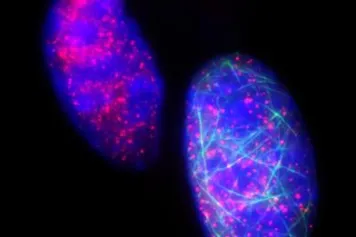 Cancer: Découverte d’une protéine contrôlant la résistance à la chimiothérapie