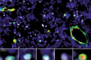 Une nouvelle immunothérapie pour lutter contre le cancer