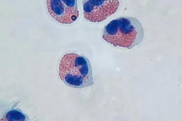 Avancées dans la compréhension des éosinophiles