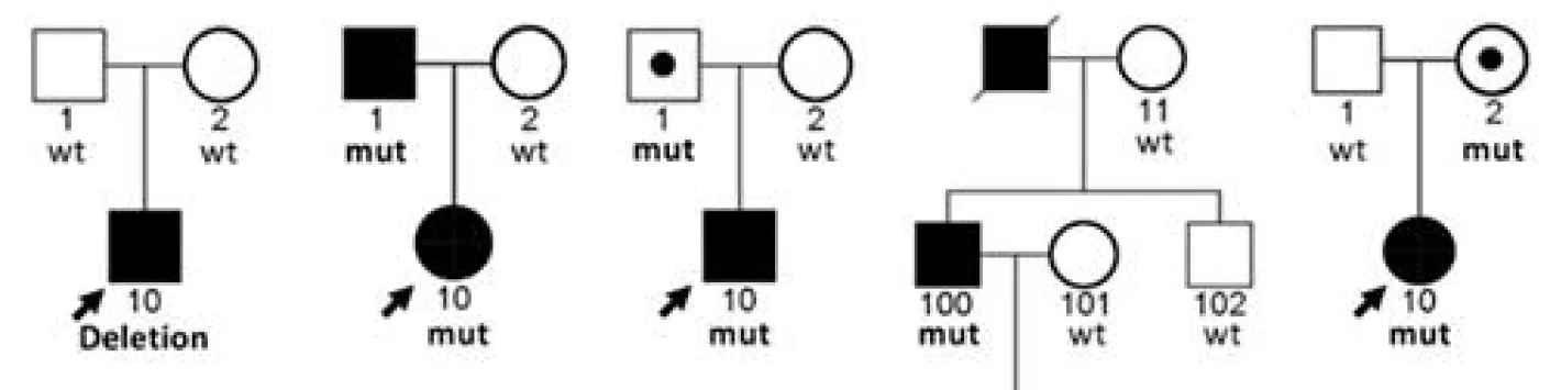 PUBLICATION SCIENTIFIQUE | Membres gonflés : une découverte permet de comprendre l'origine de la maladie
