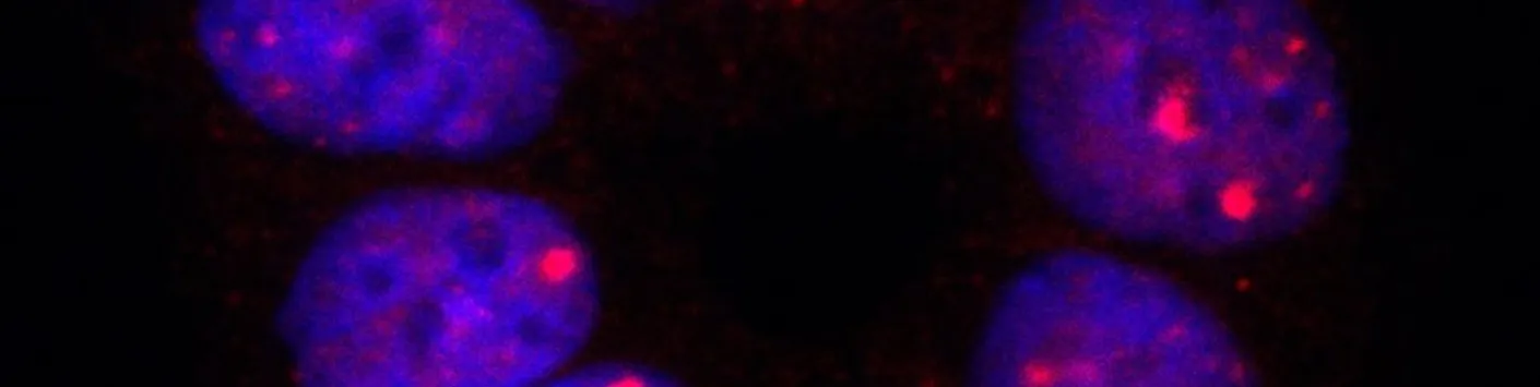 Nouvelle cible pour le traitement des tumeurs du poumon