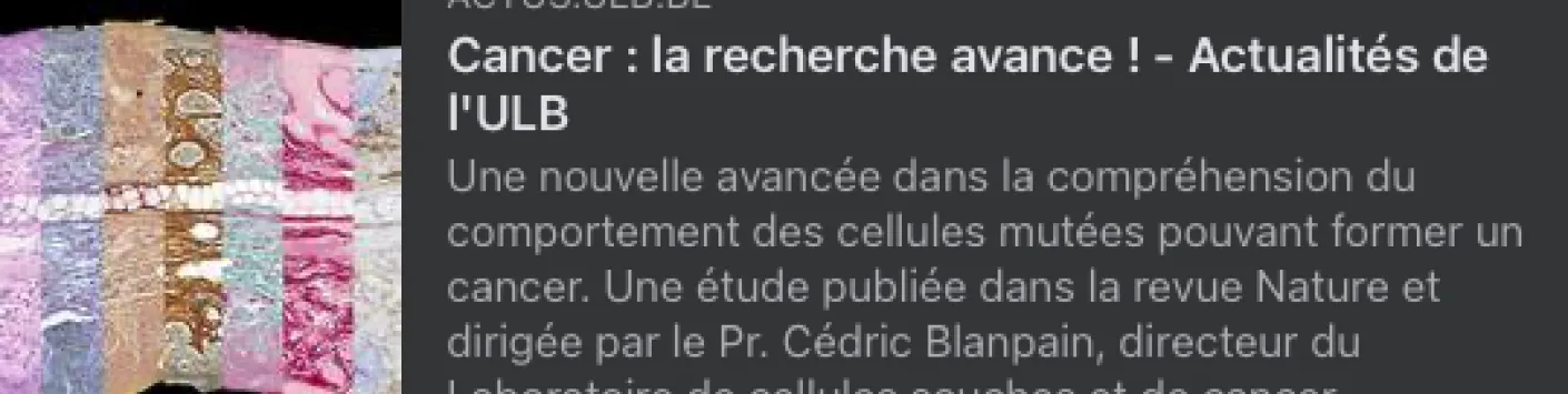Le rôle du collagène dans certains cancers de la peau : une nouvelle publication de Nordin Bansaccal, Boursier FRIA-FNRS de 2020 à 2023, et ses collègues, dirigée par Cédric Blanpain, Professeur, Promoteur d'instruments FNRS et Télévie, directeur du Labor