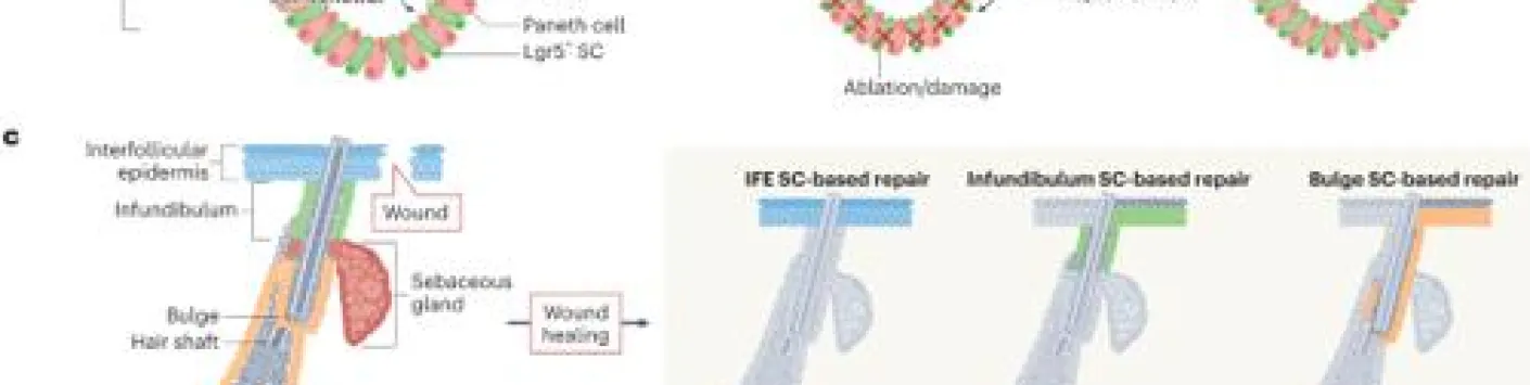 Plasticité des cellules cancéreuses au cours de la progression tumorale, des métastases et de la réponse au traitement