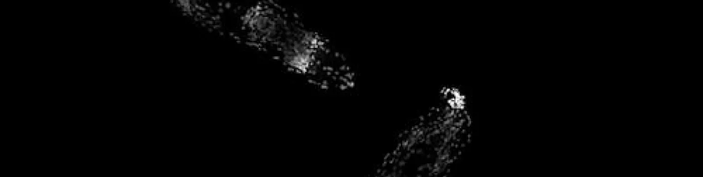 Rotifères : une avancée significative pour expliquer la résistance exceptionnelle de ces microorganismes