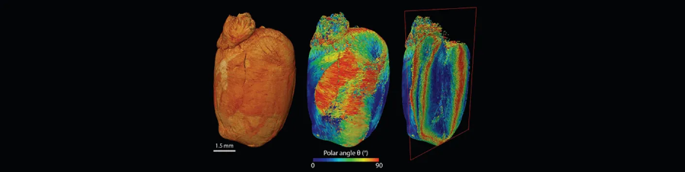Les tissus et organes en 3D pour comprendre les maladies