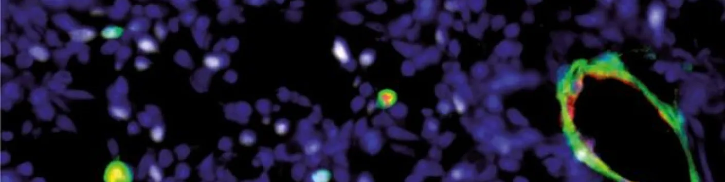 Une nouvelle immunothérapie pour lutter contre le cancer